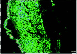 DUB SkinScanner 75 brochure02