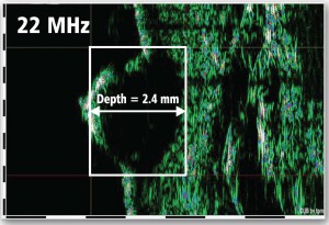 DUB-SkinScanner-75-brochure08