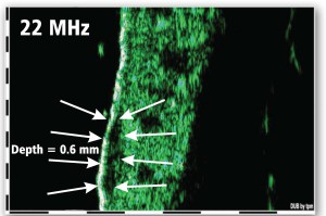 DUB-SkinScanner-75-brochure09