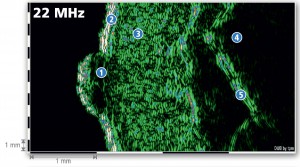 DUB SkinScanner 75 brochure10