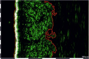 DUB SkinScanner Brochure04