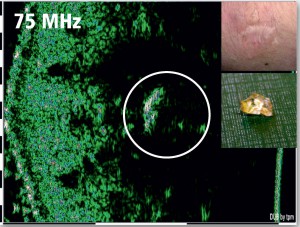 DUB-SkinScanner-Brochure07