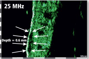 DUB-SkinScanner-Brochure09