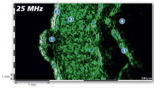 DUB-SkinScanner-Brochure10