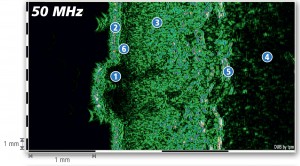 DUB-SkinScanner-Brochure11