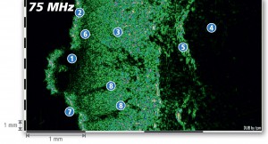 DUB-SkinScanner-Brochure12