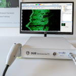 DUB SkinScanner75 newHousing