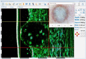 DUB cutis brochure05