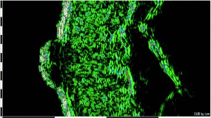 DUB cutis brochure06