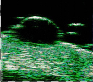 DUB cutis brochure09