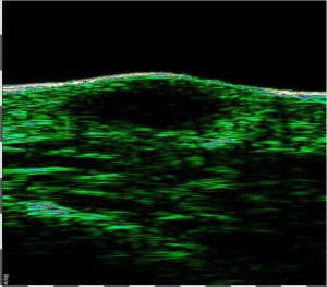 DUB cutis brochure10