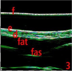 HFUS Plastic Surgery applications 01