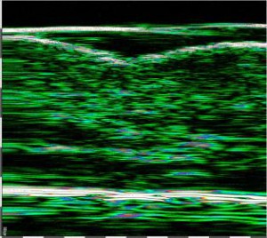 HFUS Plastic Surgery applications 02