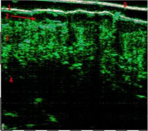 HFUS Plastic Surgery applications 03