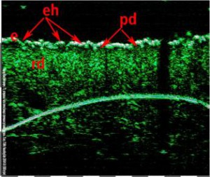 HFUS Plastic Surgery applications 04