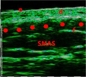 HFUS Plastic Surgery applications 05