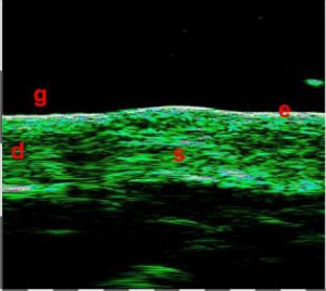 HFUS Plastic Surgery applications 06