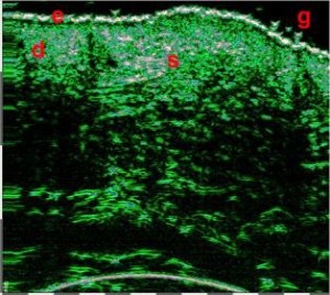 HFUS Plastic Surgery applications 07
