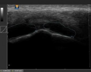 HFUS Plastic Surgery applications 12