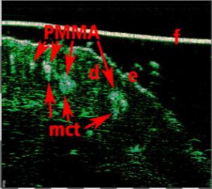 HFUS Plastic Surgery applications 13