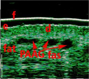 HFUS Plastic Surgery applications 15