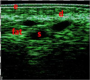 HFUS Plastic Surgery applications 16