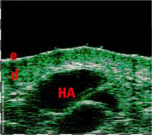 HFUS Plastic Surgery applications 17