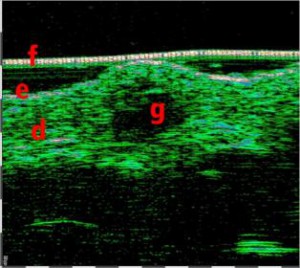 HFUS Plastic Surgery applications 18