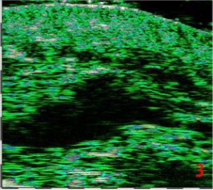 HFUS Plastic Surgery applications 19