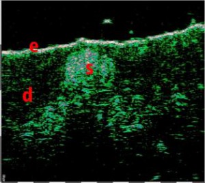 HFUS Plastic Surgery applications 20