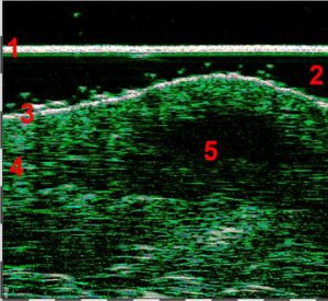 HFUS Plastic Surgery applications 21