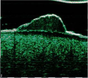 HFUS Plastic Surgery applications 22