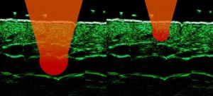 HFUS Plastic Surgery applications 23