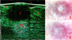 tpm Motivation Oncology 01