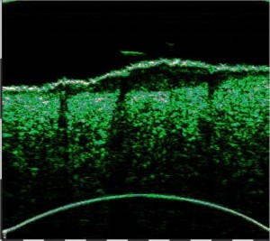 tpm Motivation Oncology 02