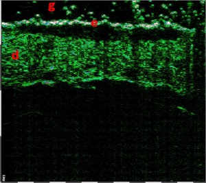 tpm Motivation Oncology 03