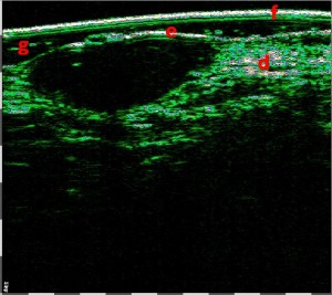 tpm Motivation Oncology 04