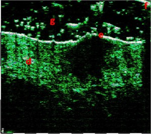 tpm Motivation Oncology 05