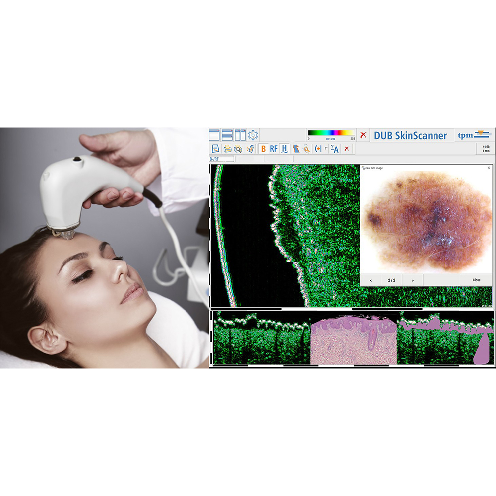 tpm Motivation general