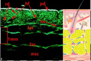 tpm Plastic surgery 01