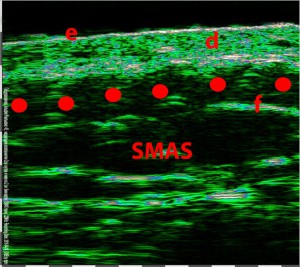 tpm Plastic surgery 06