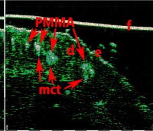 tpm Plastic surgery 13