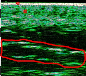 tpm Plastic surgery 19