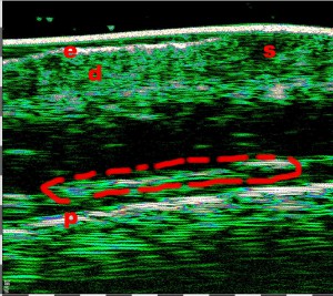 tpm Plastic surgery 20