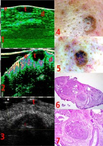 tpm Plastic surgery 26