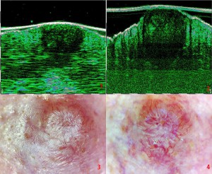 tpm Plastic surgery 27