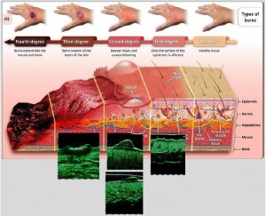 tpm plastic surgery 23